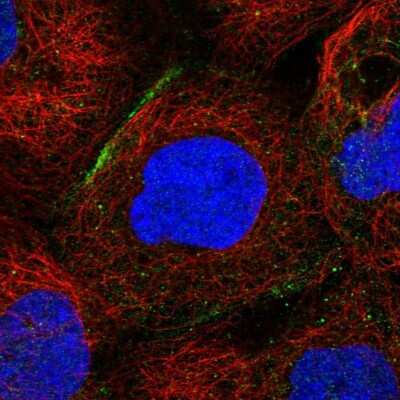 Immunocytochemistry/ Immunofluorescence: SHKBP1 Antibody [NBP1-87252]