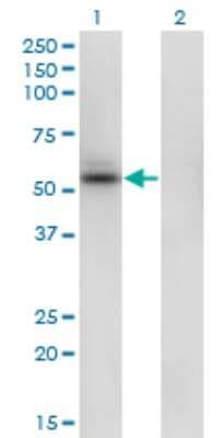 Western Blot: SHMT1 Antibody (4F9) [H00006470-M01]
