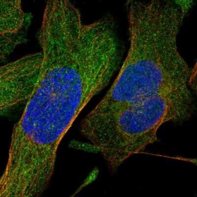 Immunocytochemistry/ Immunofluorescence: SHMT1 Antibody [NBP1-85437]