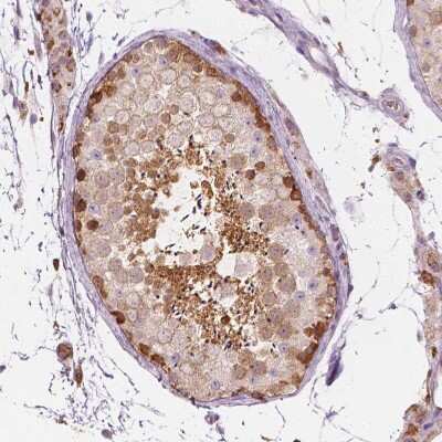 Immunohistochemistry-Paraffin: SHMT1 Antibody [NBP1-85437]