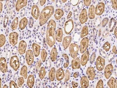 Immunohistochemistry-Paraffin: SHMT1 Antibody [NBP2-97303]