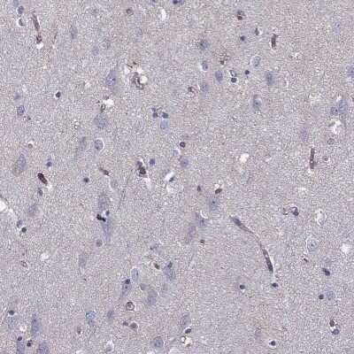 Immunohistochemistry-Paraffin: SHMT1 Antibody [NBP3-17022]