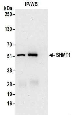 Immunoprecipitation: SHMT1 Antibody [NBP2-32173]