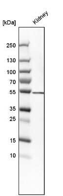 Western Blot: SHMT1 Antibody [NBP1-85437]