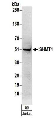 Western Blot: SHMT1 Antibody [NBP2-32173]