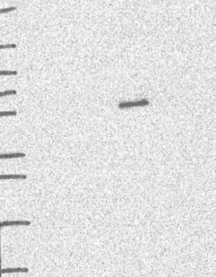 Western Blot: SHMT1 Antibody [NBP3-17022]