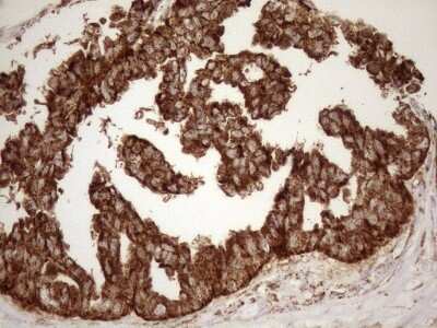 Immunohistochemistry: SHMT2 Antibody (OTI3E9) [NBP2-45826]