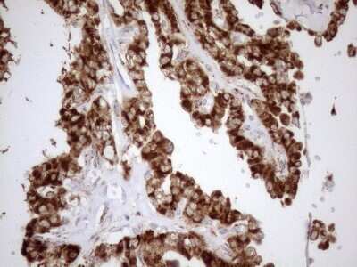 Immunohistochemistry: SHMT2 Antibody (OTI3E9) [NBP2-45826]