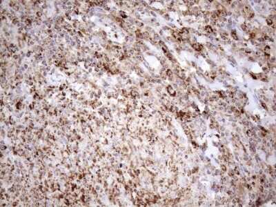 Immunohistochemistry: SHMT2 Antibody (OTI3E9) [NBP2-45826]