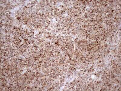 Immunohistochemistry: SHMT2 Antibody (OTI3E9) [NBP2-45826]