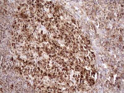 Immunohistochemistry: SHMT2 Antibody (OTI3E9) [NBP2-45826]