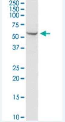 Western Blot: SHMT2 Antibody (5E7) [H00006472-M04-100ug]