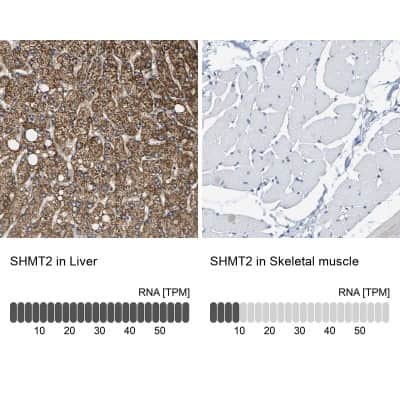 Immunohistochemistry-Paraffin: SHMT2 Antibody [NBP1-80755]