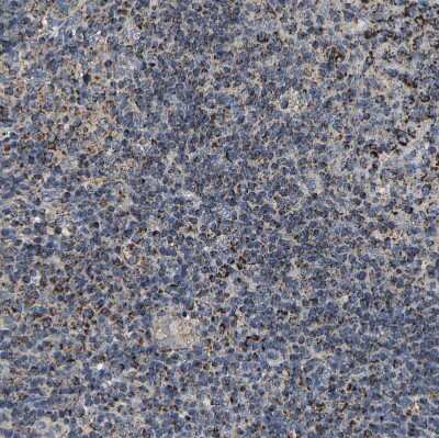 Immunohistochemistry-Paraffin: SHMT2 Antibody [NBP1-80755]