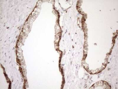 Immunohistochemistry: SHMT2 Antibody (OTI3E9) - Azide and BSA Free [NBP2-74171]