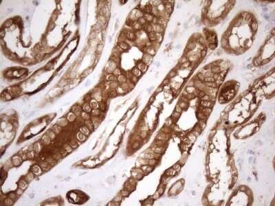 Immunohistochemistry: SHMT2 Antibody (OTI3E9) - Azide and BSA Free [NBP2-74171]