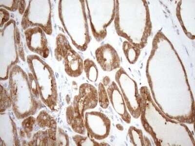 Immunohistochemistry: SHMT2 Antibody (OTI3E9) - Azide and BSA Free [NBP2-74171]
