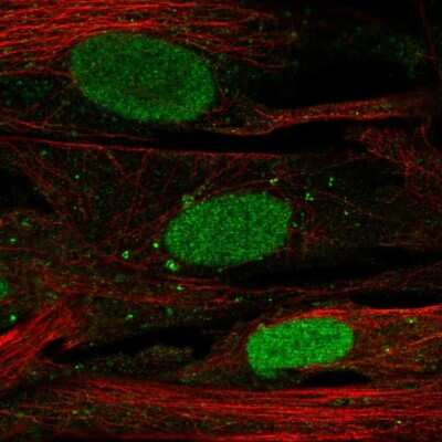 Immunocytochemistry/ Immunofluorescence: SHOX Antibody [NBP2-55181]
