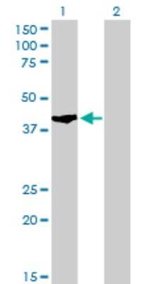 Western Blot: SHOX2 Antibody (1D1) [H00006474-M01]