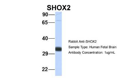 Western Blot: SHOX2 Antibody [NBP2-86805]