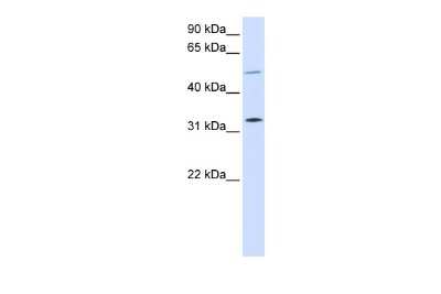 Western Blot: SHOX2 Antibody [NBP2-86808]