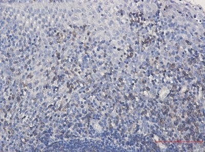 Immunohistochemistry-Paraffin: SHP-1 Antibody (S06-4C8) [NBP3-19611]