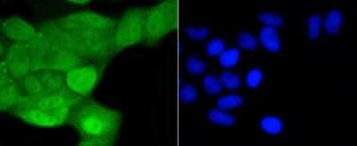 Immunocytochemistry/ Immunofluorescence: SHP-1 Antibody (SR41-02) [NBP2-67321]