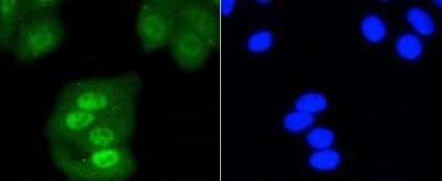 Immunocytochemistry/ Immunofluorescence: SHP-1 Antibody (SR41-02) [NBP2-67321]