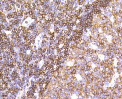 Immunohistochemistry-Paraffin: SHP-1 Antibody (SR41-02) [NBP2-67321]
