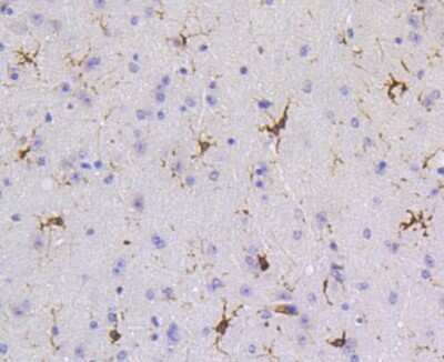 Immunohistochemistry-Paraffin: SHP-1 Antibody (SR41-02) [NBP2-67321]