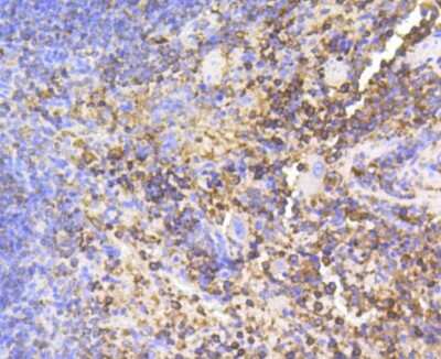Immunohistochemistry-Paraffin: SHP-1 Antibody (SR41-02) [NBP2-67321]