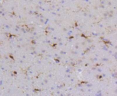 Immunohistochemistry-Paraffin: SHP-1 Antibody (SR41-02) [NBP2-67321]