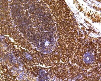 Immunohistochemistry-Paraffin: SHP-1 Antibody (SR41-02) [NBP2-67321]