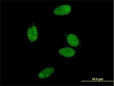 Immunocytochemistry/ Immunofluorescence: SHP/NR0B2/Nuclear Receptor SHP Antibody (1A11) [H00008431-M01]