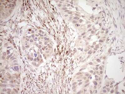 Immunohistochemistry: SHP/NR0B2/Nuclear Receptor SHP Antibody (OTI7B5) [NBP2-46522]
