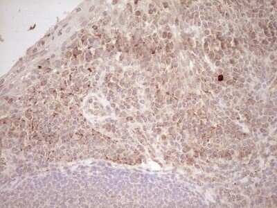 Immunohistochemistry: SHP/NR0B2/Nuclear Receptor SHP Antibody (OTI7B5) [NBP2-46522]