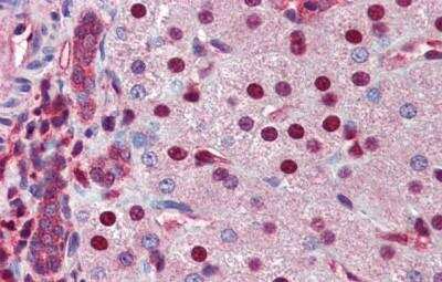 Immunohistochemistry-Paraffin: SHP/NR0B2/Nuclear Receptor SHP Antibody [NBP1-52817]
