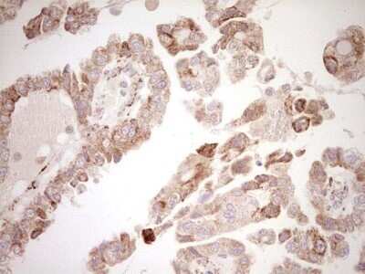 Immunohistochemistry: SHP/NR0B2/Nuclear Receptor SHP Antibody (OTI7B5) - Azide and BSA Free [NBP2-74172]