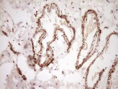 Immunohistochemistry: SHP/NR0B2/Nuclear Receptor SHP Antibody (OTI7B5) - Azide and BSA Free [NBP2-74172]