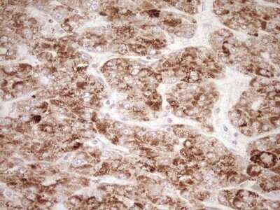 Immunohistochemistry: SHP/NR0B2/Nuclear Receptor SHP Antibody (OTI7B5) - Azide and BSA Free [NBP2-74172]