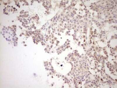 Immunohistochemistry: SHP/NR0B2/Nuclear Receptor SHP Antibody (OTI7B5) - Azide and BSA Free [NBP2-74172]