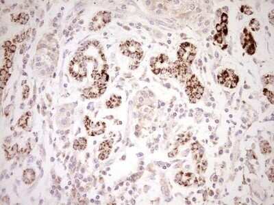 Immunohistochemistry: SHP/NR0B2/Nuclear Receptor SHP Antibody (OTI7B5) - Azide and BSA Free [NBP2-74172]