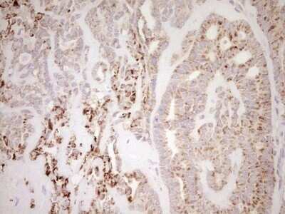 Immunohistochemistry: SHP/NR0B2/Nuclear Receptor SHP Antibody (OTI7B5) - Azide and BSA Free [NBP2-74172]