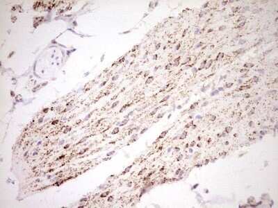 Immunohistochemistry: SHP/NR0B2/Nuclear Receptor SHP Antibody (OTI7B5) - Azide and BSA Free [NBP2-74172]