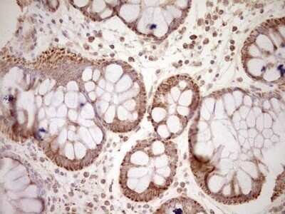 Immunohistochemistry: SHP/NR0B2/Nuclear Receptor SHP Antibody (OTI7B5) - Azide and BSA Free [NBP2-74172]