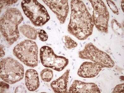 Immunohistochemistry: SHP/NR0B2/Nuclear Receptor SHP Antibody (OTI7B5) - Azide and BSA Free [NBP2-74172]