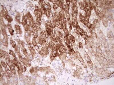 Immunohistochemistry: SHP/NR0B2/Nuclear Receptor SHP Antibody (OTI7B5) - Azide and BSA Free [NBP2-74172]