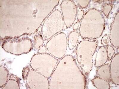 Immunohistochemistry: SHP/NR0B2/Nuclear Receptor SHP Antibody (OTI7B5) - Azide and BSA Free [NBP2-74172]