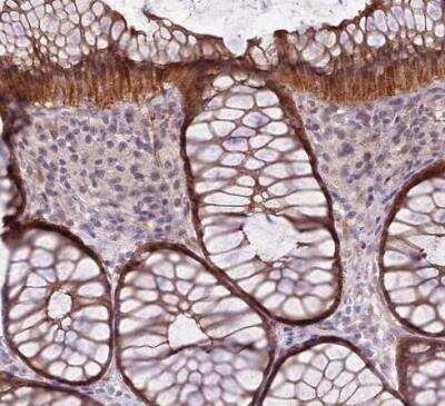 Immunohistochemistry-Paraffin: SHROOM3 Antibody [NBP2-14617]