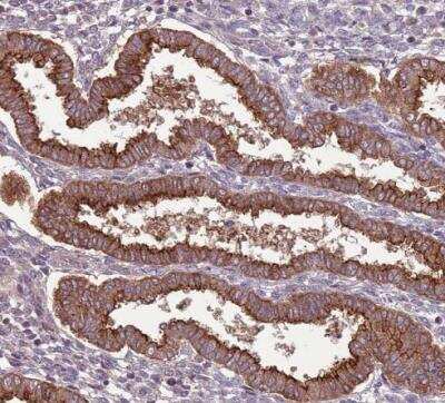 Immunohistochemistry-Paraffin: SHROOM3 Antibody [NBP2-14617]